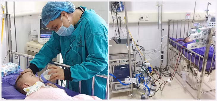 Bệnh nhi được cứu sống nhờ kỹ thuật ECMO. Ảnh do Bệnh viện Sản Nhi cung cấp.