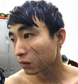 Trên mặt nghi can có nhiều vết cào cấu của nạn nhân. Ảnh: L.S.