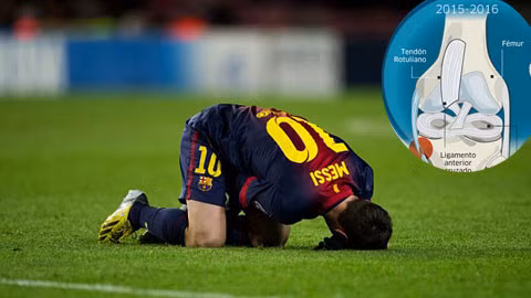 Hình ảnh chấn thương (ảnh nhỏ) đứt dây chằng đầu gối trái của Messi