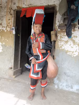 Hơn 20 năm qua, bà Múi phải mang bên mình khối u nặng hàng chục kg.
