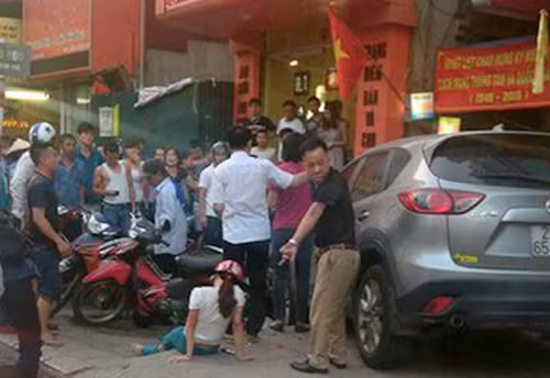 Người phụ nữ đi xe máy bị ôtô đâm gãy chân. Ảnh: Giang Trịnh