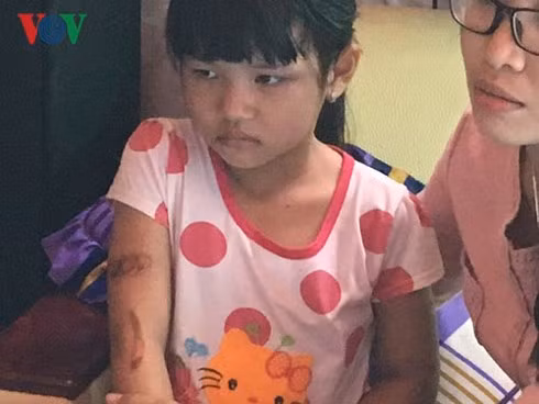 Bé Thảo rất sợ sệt, luôn đưa mắt nhìn mẹ kế khi trả lời.