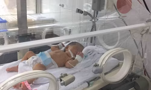 Trong số 7 trẻ được chuyển đến Bệnh viện Phụ sản Trung ương, 3 bé có cân nặng dưới 1,5 kg phải nằm nuôi dưỡng lâu dài tại viện. Ảnh: Ngọc Thảo. 