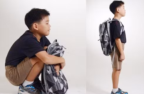 Trẻ đeo cặp không đúng tư thế có nguy cơ bị vẹo cột sống.