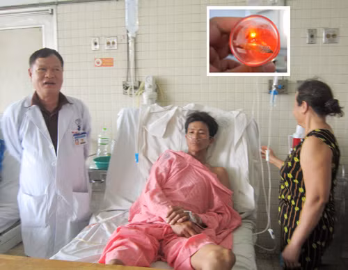 Bệnh nhân được mổ lấy miếng xương gà bị hóc (ảnh nhỏ) được điều trị tại Bệnh viện Chợ Rẫy - Ảnh: Nguyên Mi
