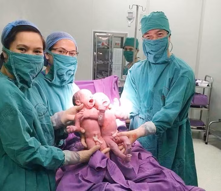 2 bé trai sinh đôi đầu tiên ra đời nhờ thụ tinh ống nghiệm IVF tại Bệnh viện Sản Nhi Quảng Ninh. Ảnh do Bệnh viện cung cấp.