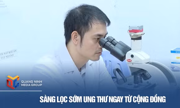 Sàng lọc sớm ung thư ngay từ cộng đồng