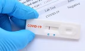Test nhanh COVID 19