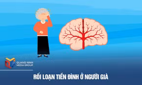 Rối loạn tiền đình ở người già