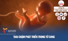 Thai chậm phát triển trong tử cung