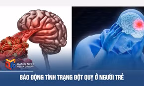 Báo động tình trạng đột quỵ ở người trẻ