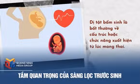 Tầm quan trọng của sàng lọc trước sinh