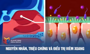 Nguyên nhân, triệu chứng và điều trị viêm xoang