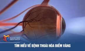 Tìm hiểu về bệnh thoái hóa điểm vàng