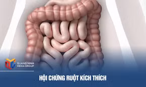 Hội chứng ruột kích thích