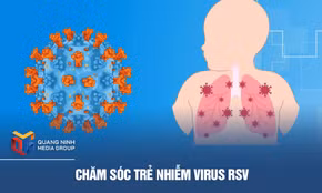 Chăm sóc trẻ nhiễm virus RSV
