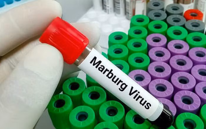 Nâng cao cảnh giác với bệnh do virus Marburg​ ảnh 1