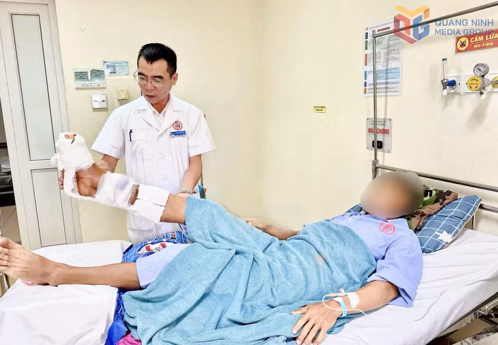 Bác sĩ kiểm tra chân người bệnh sau phẫu thuật nối cẳng chân phải. Ảnh do bệnh viện cung cấp