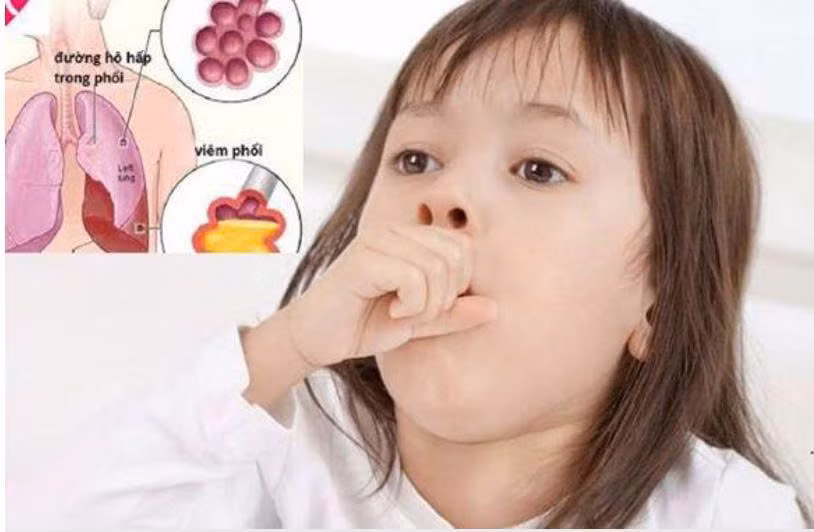 Trẻ nhỏ khi ra đường rất dễ bị lạnh vùng mũi họng - nơi nhạy cảm và dễ tổn thương nhất