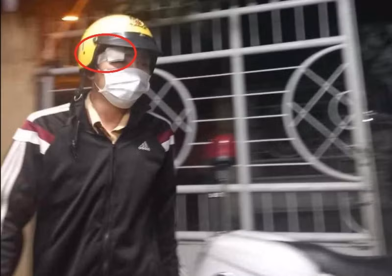Đại úy Phạm Tấn Thịnh bị tấn công ở vùng đầu.