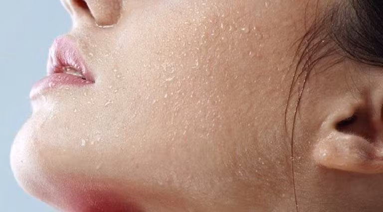 Khi trời trở lạnh, nhiệt độ giảm đột ngột nếu không chăm sóc đúng sẽ gây khô da. Ảnh minh họa
