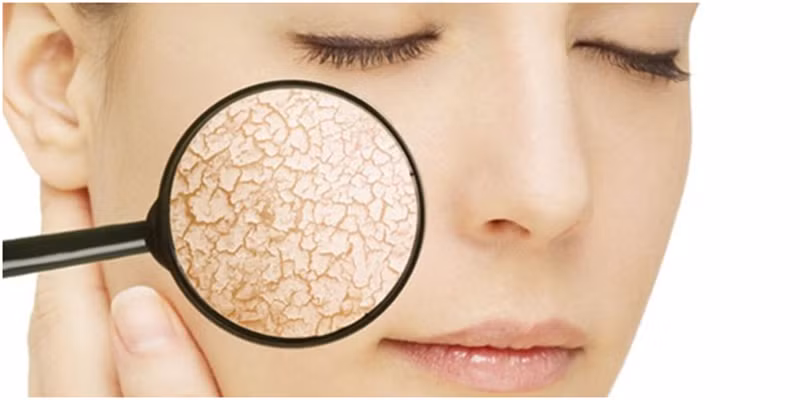 Khí hậu khắc nghiệt - một trong nhưng nguyên nhân dẫn đến da khô dù mùa hè hay mùa đông.