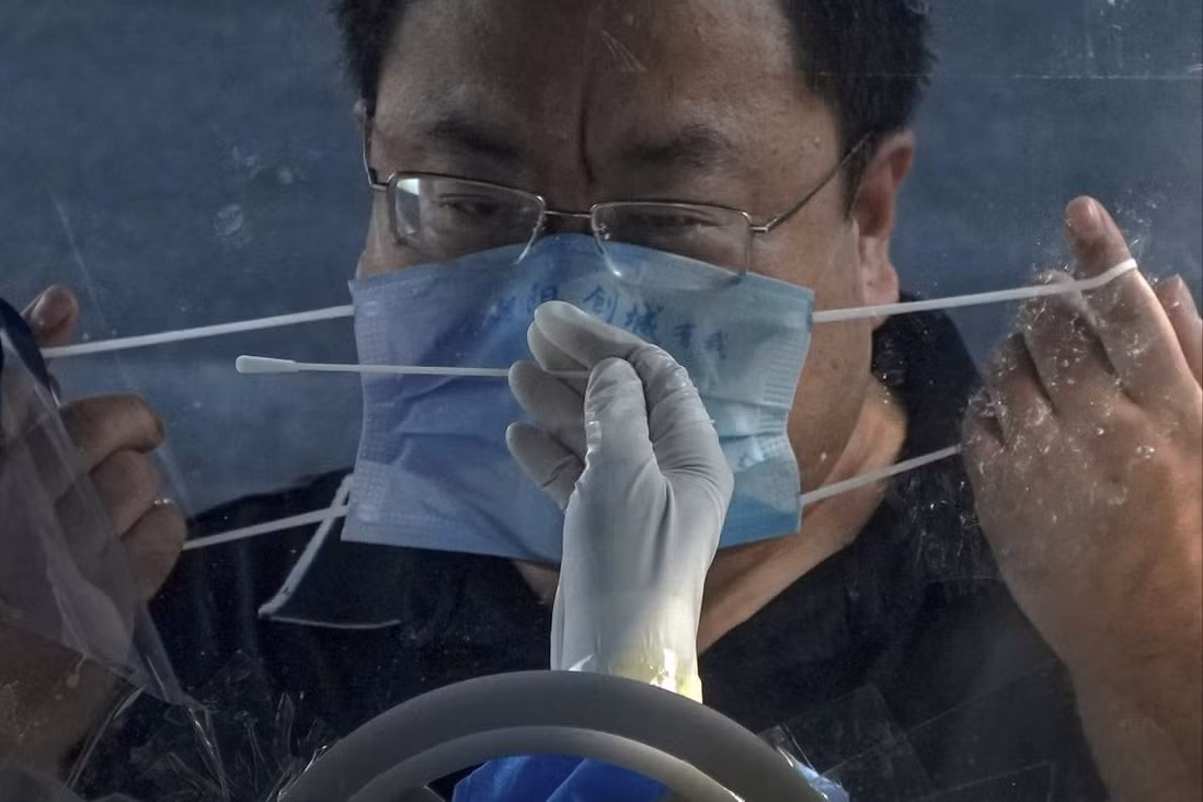 Người đàn ông tháo khẩu trang để xét nghiệm virus SARS-CoV-2 ở Bắc Kinh, Trung Quốc. Ảnh: AP