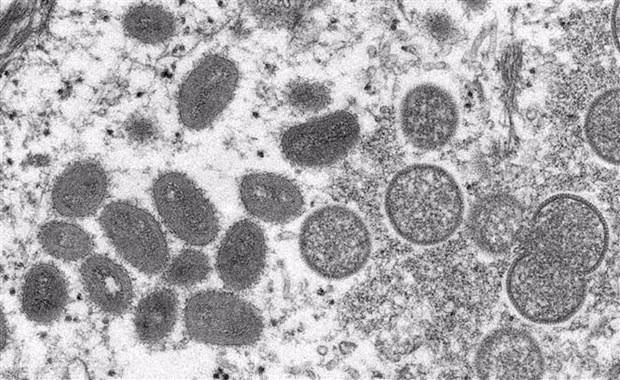 TP.HCM: Benh nhan dau tien mac dau mua khi da am tinh voi virus hinh anh 1