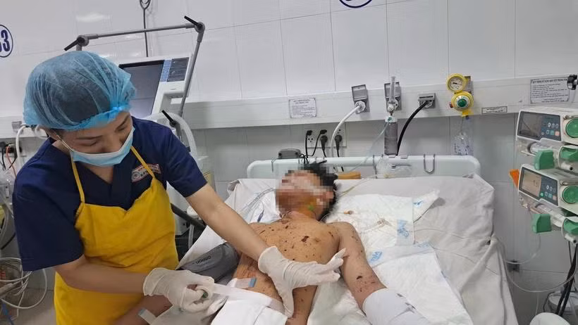 Một bệnh nhân bị chấn thương do pháo nổ. (Ảnh: TTXVN phát)