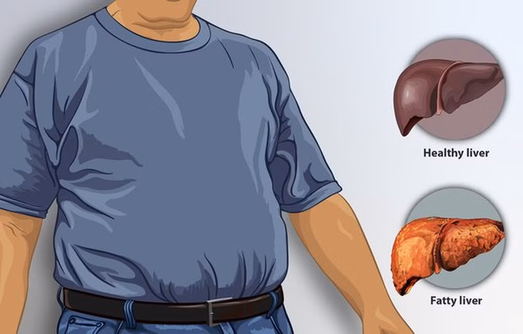 Để có sức khỏe tốt, bạn cần bảo vệ lá gan khỏe mạnh (Ảnh: Quora).