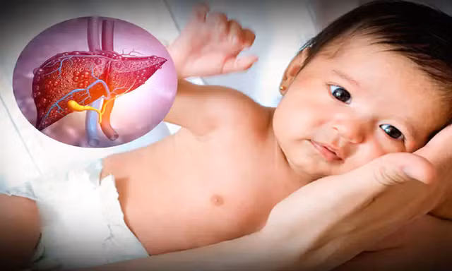 Bệnh gan ở trẻ thường do viêm nhiễm, di truyền, rối loạn chuyển hóa hoặc bệnh mạn tính