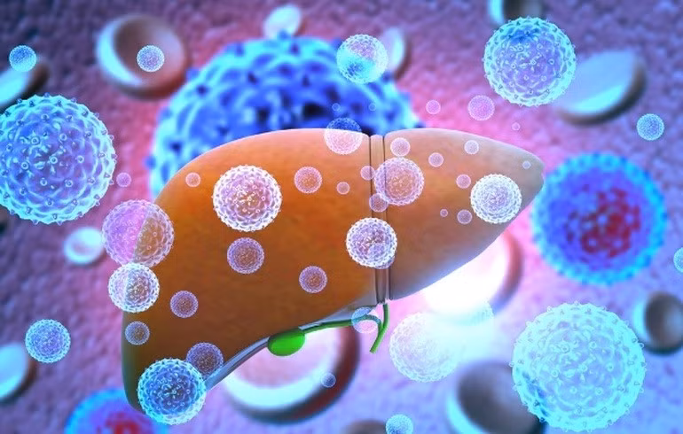 Viêm gan do virus bí ẩn đã khiến 3 trẻ ở Đông Nam Á thiệt mạng (Ảnh minh họa).