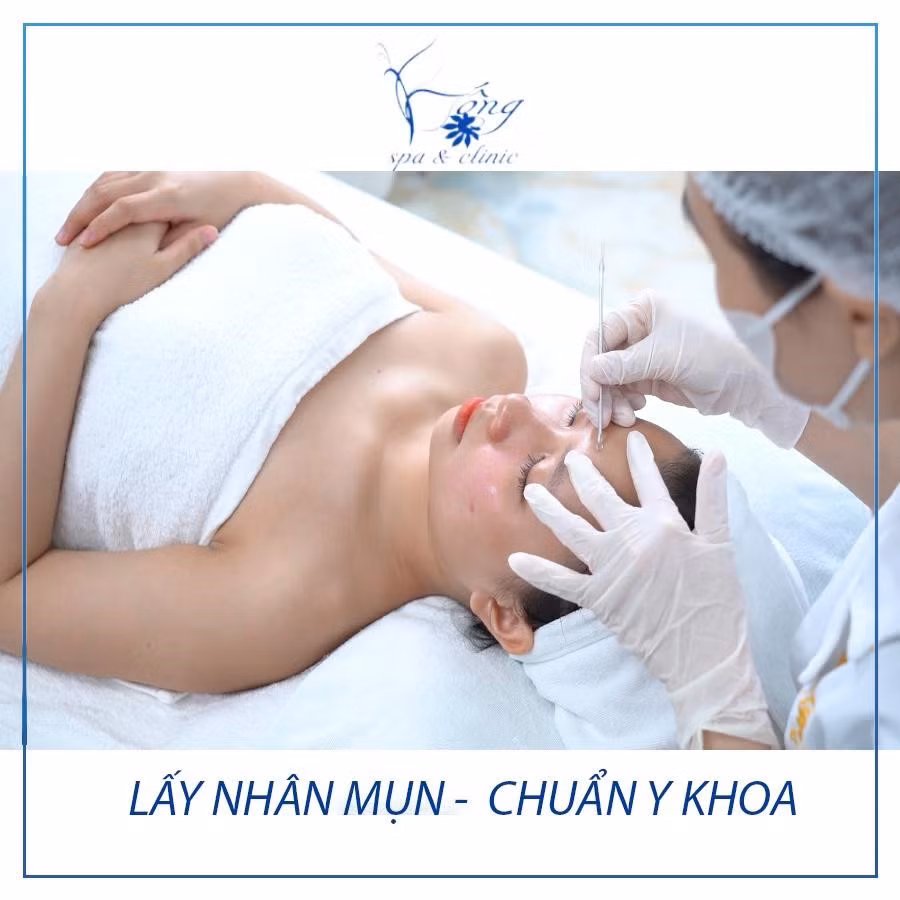 Spa trị mụn nam uy tín hiệu quả, cam kết sạch mụn đến 90% ảnh 3