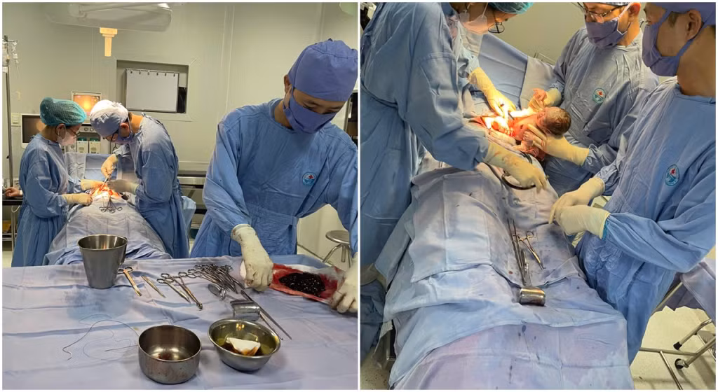 Các y, bác sĩ Trung tâm Y tế huyện Đầm Hà đã kịp thời phẫu thuật cấp cứu cho sản phụ bị rau bong non.