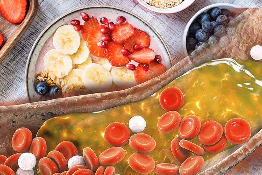 Cholesterol đóng một vai trò quan trọng trong hoạt động của các tế bào, nhưng nó có thể trở nên nghiêm trọng nếu đạt đến mức bất thường trong máu. Đồ họa: THIỆN NHÂN
