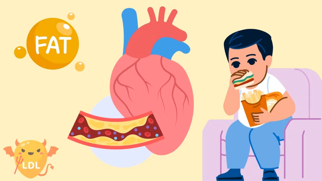 Thói quen vô tình khiến cholesterol tăng cao. Đồ họa: Bảo Anh