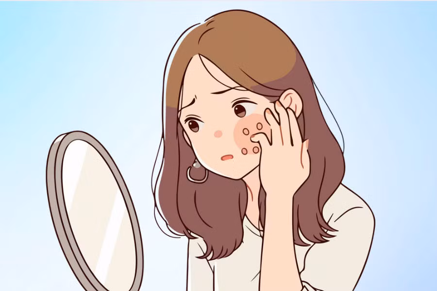 Căng thẳng không chỉ tác động đến tinh thần mà còn nhanh chóng biểu hiện trên làn da. Đồ họa: Thiện Nhân