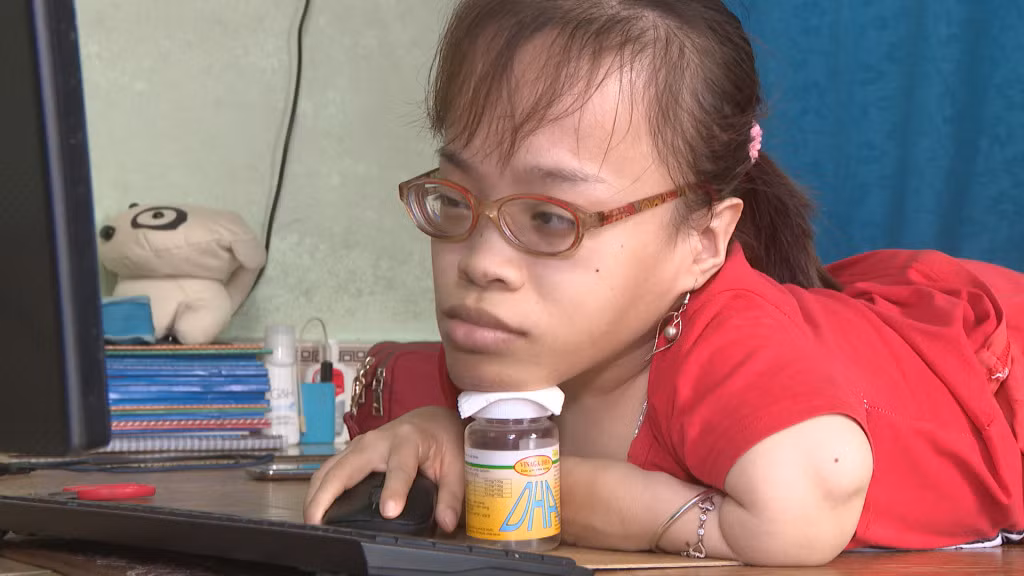 Cô gái "xương thủy tinh" Phạm Thị Hoài Thương theo học chương trình Đại học từ xa.