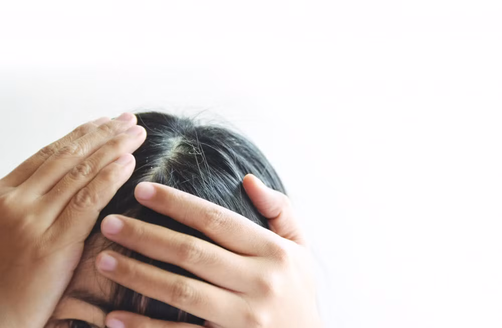Tự nhuộm tóc bạc coi chừng rước họa ảnh 1