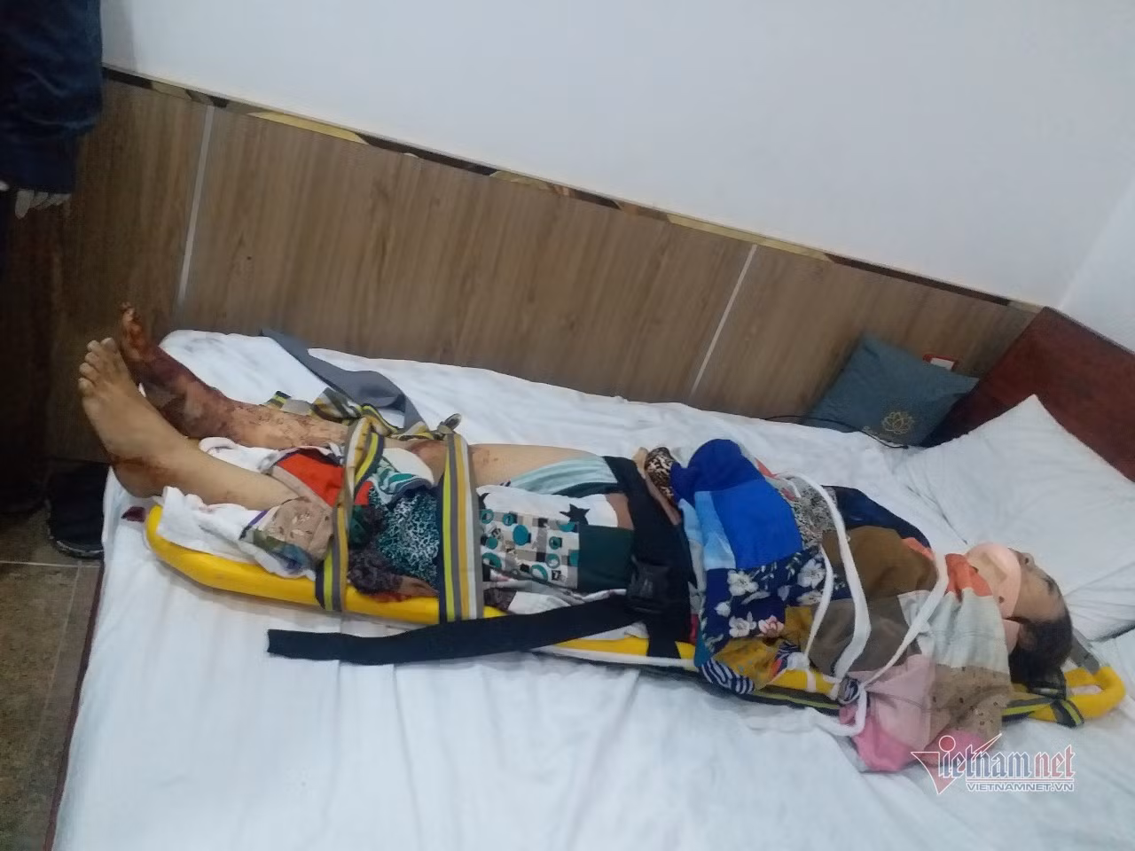 Cô gái bị chấn thương cột sống được giải cứu khỏi thang máy và chuyển đi bệnh viện cấp cứu