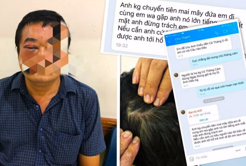 Một số vết thương trên người ông H và tin nhắn đe dọa mà ông H nhận được.