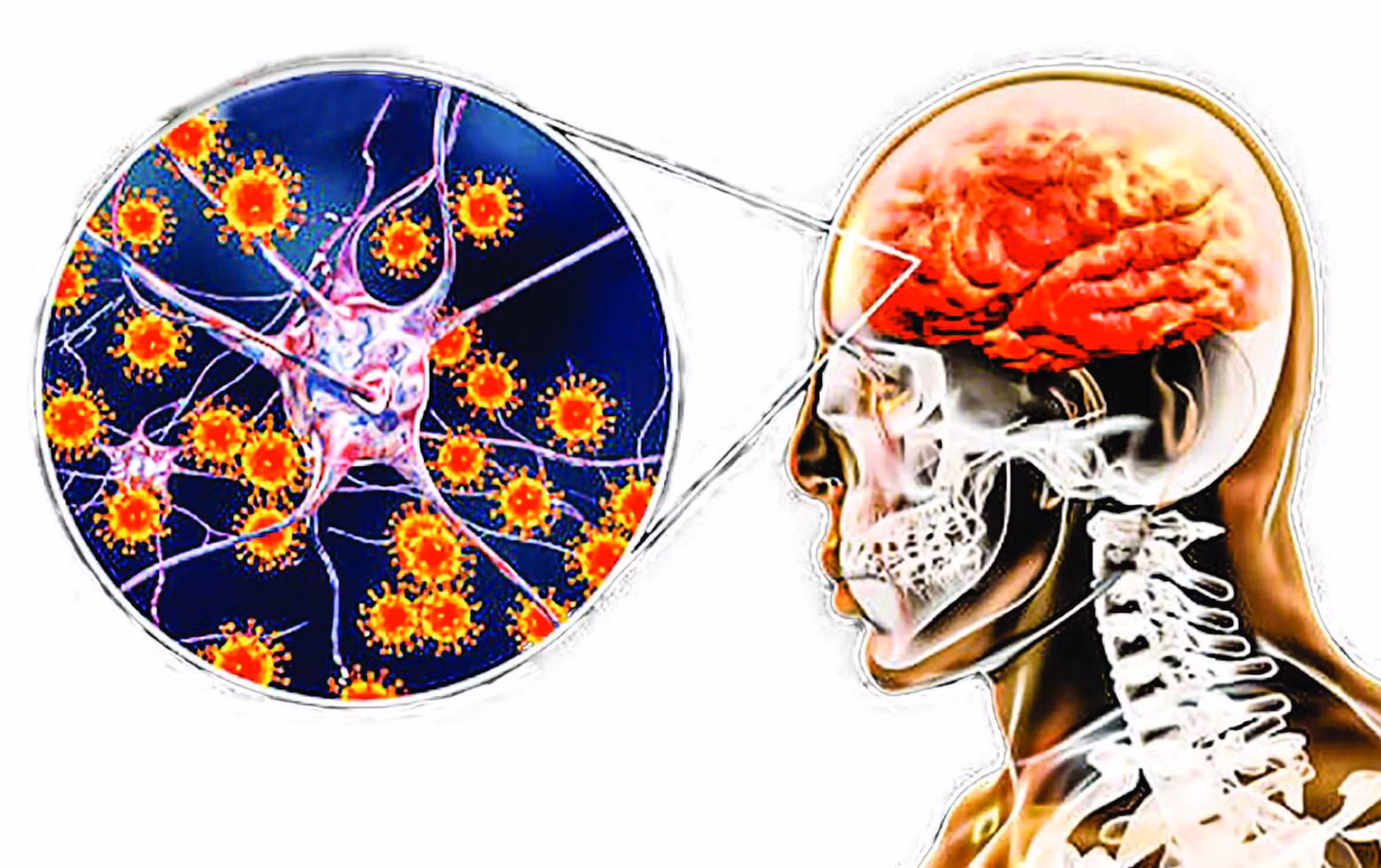 Viêm não Nhật Bản là bệnh do một loại virus thuộc họ Togaviridae ở trong nhóm B của các Flavivirus gây ra.