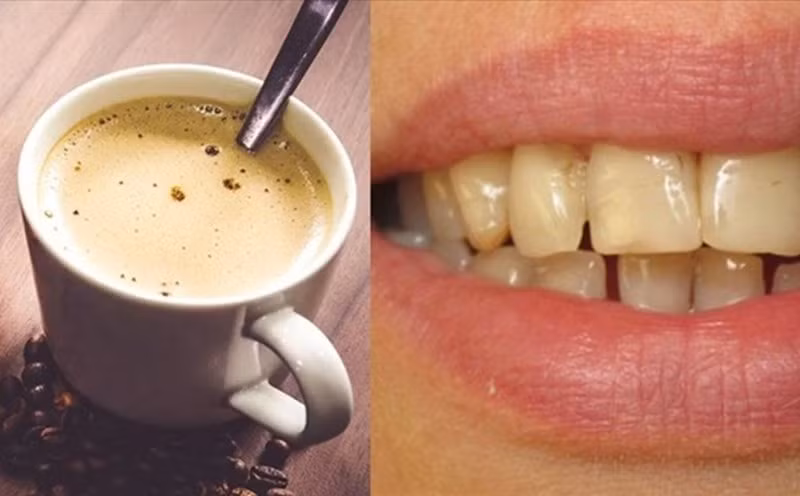 Cà phê có thể khiến răng ố vàng. Đồ họa: Việt Anh