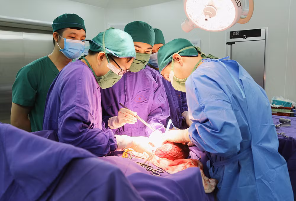 Kíp y, bác sĩ Bệnh viện Đa khoa tỉnh thực hiện ca phẫu thuật cắt khối u tinh hoàn ác tính kích thước lớn cho nam bệnh nhân trẻ tuổi.