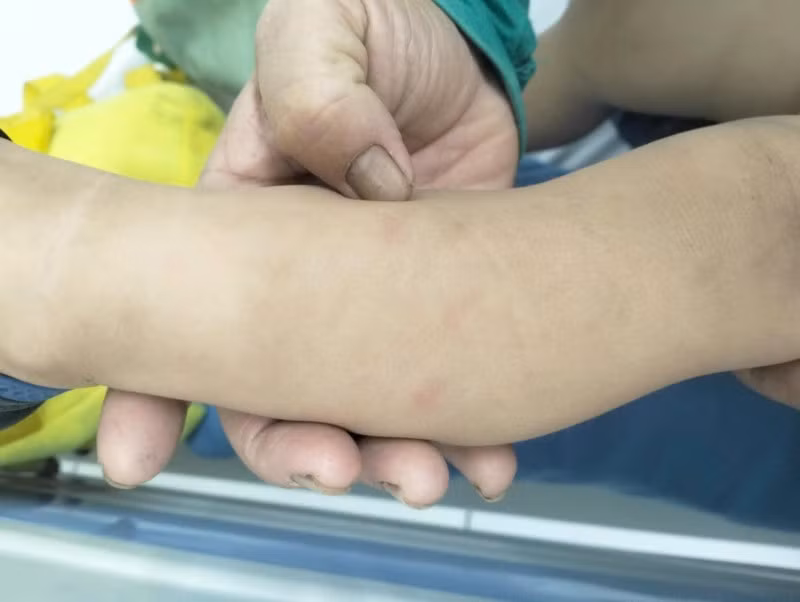 Bảo mẫu bạo hành trẻ ở Quảng Nam, gia đình phẫn nộ vì con hoảng loạn giữa đêm ảnh 2