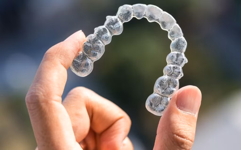 Hướng dẫn vệ sinh khay niềng răng Invisalign đúng cách ảnh 1
