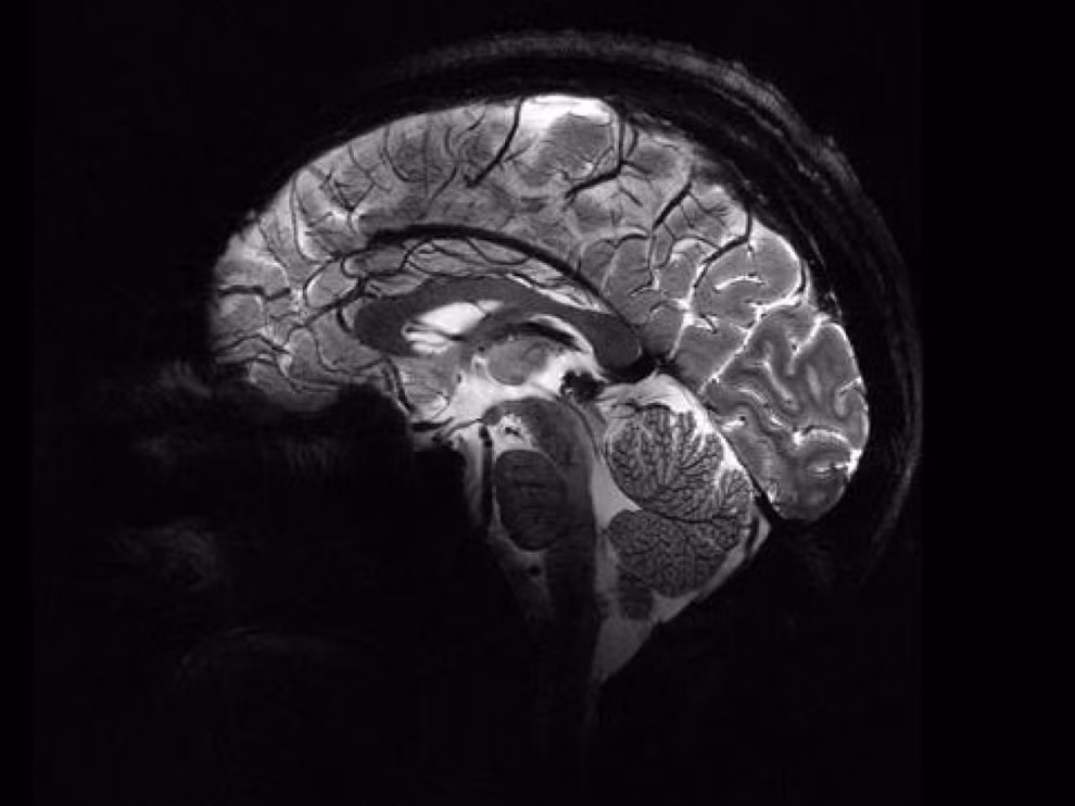Bộ não người chụp từ máy quét MRI Iseult (Ảnh: CEA).