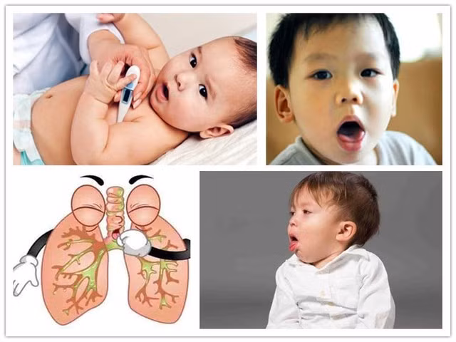 Trẻ em mắc bệnh viêm đường hô hấp thường gây ho.