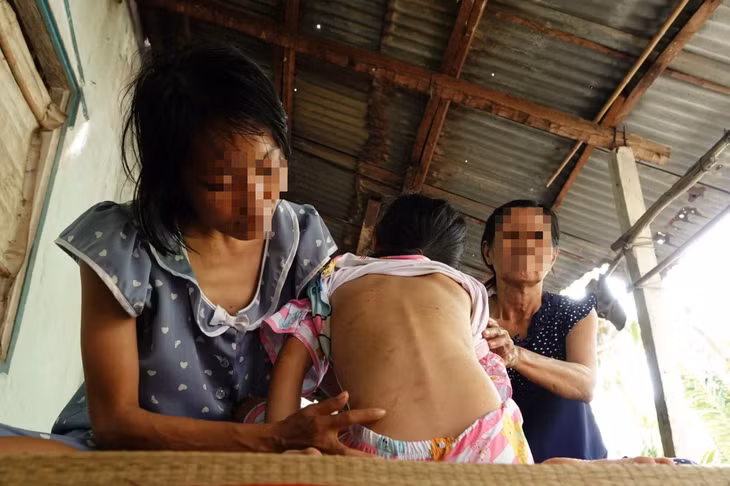 Nam thanh niên đánh đập hai mẹ con "vợ hờ" gây thương tích đầy mình - Ảnh: LINH KỲ