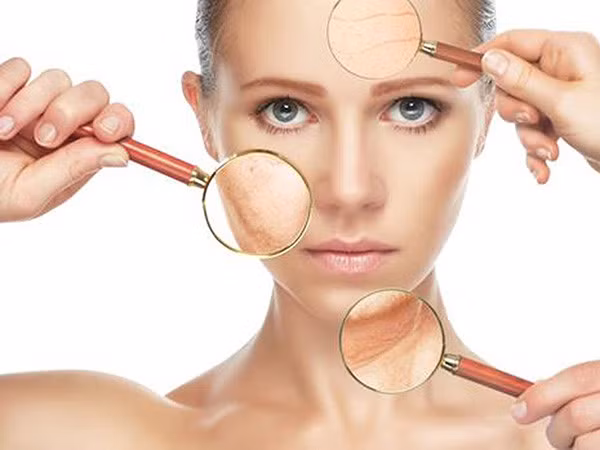 Sự suy giảm collagen khiến da bị lão hóa.